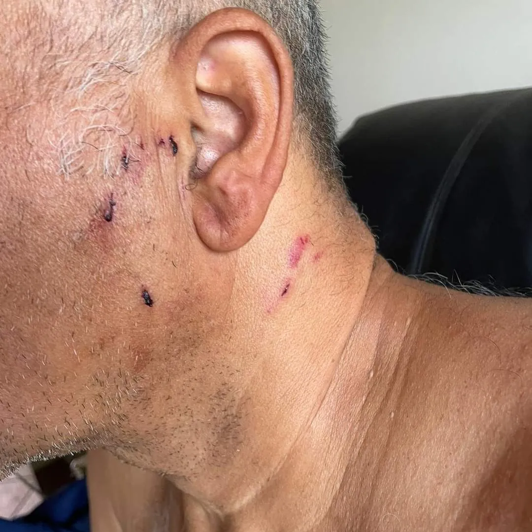 Morador é atacado por dois cachorros dentro de condomínio em Cajamar 