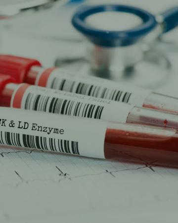 Faculdade do ABC abre inscrições para pesquisa de câncer de mama por exame de sangue