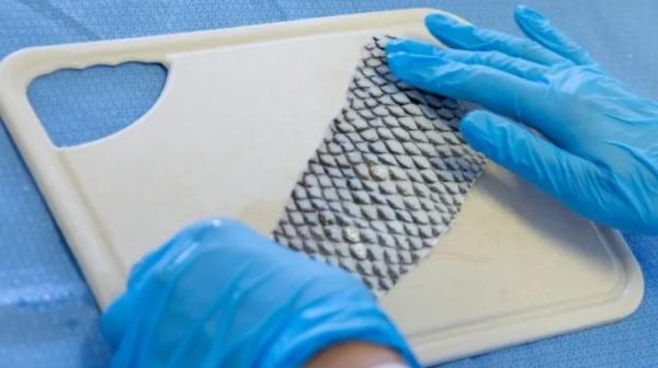 Brasil terá primeira fábrica do mundo de curativos feitos com pele de tilápia